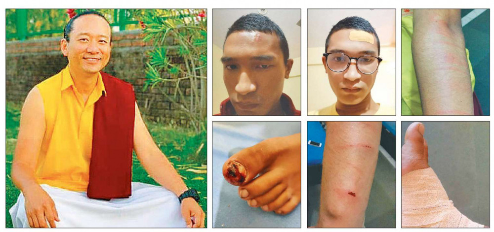 देहरादून घटनास् विद्यार्थीको निःशुल्क उपचार गर्न नेपाल विद्यार्थी सङ्घको माग